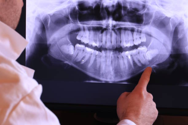 Best Emergency TMJ Treatment in Mount Clemens, MI