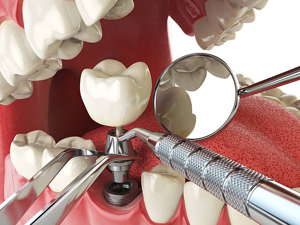 Best Same-Day Emergency Dental Services in Mount Clemens, MI